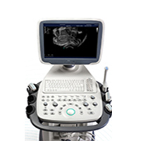 Sonoscape S12 Trolly Color Ultrasound