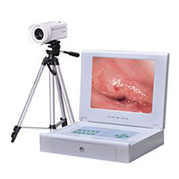 Portable Type Digital Colposcope LT-9100A   