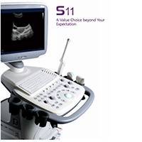 Sonoscape S11 Color trolley ultrasound