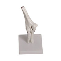 Elbow Joint Model LT-11201-2 