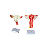 Female Internal Genital Model LT-15108 